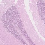 New research challenges our understanding of cancer predisposition