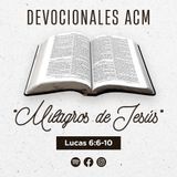 Milagros de Jesús | Lucas 6:6-10