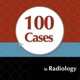 100 Cases in Radiology
