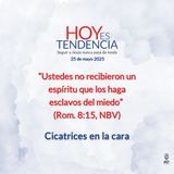 Cicatrices en la cara ~ Devocional de Jóvenes ~ 25 de mayo 2025