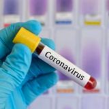 ¿Qué podemos hacer nosotros ante el Coronavirus si éste llega a México?