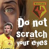 Do Not Scratch Your Eyes - Jay DeMerit Special - S1 Ep12