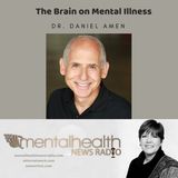 The Brain On Mental Illness