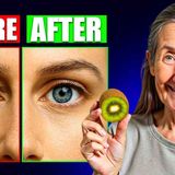 EYE DOCTORS SHOCKED_ REVERSE Vision Loss in JUST 7 Days__ Barbara O_Neill