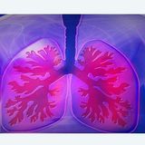 Understanding Chronic Bronchitis and the Treatment(Podcast)