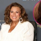 ‘Dance Moms’ Star Abby Lee Miller Gushes Over ‘Amazing’ Results of $1K Ear Rejuvenation Procedure