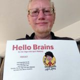 Jason LaBarre, _KLINEFELTER SYNDROME (47,XXY) Who knew ?