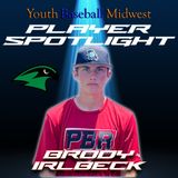 Player Spotlight | Staley: Brody Irlbeck | YBMcast
