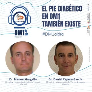 El pie diabético en DM1 también existe.