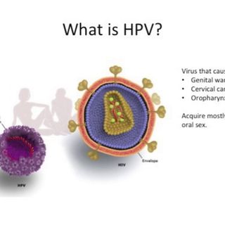 HPV in Head and Neck Cancer, Part 1: What is it and What Does it Mean? (video)
