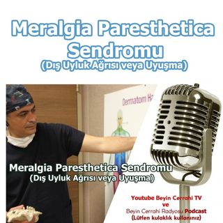 Meraljia parestetika. Prof. Dr. Duran Berker Cemil.