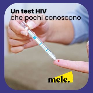 Un test HIV che pochi conoscono