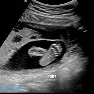 Ep. 7 - Our Fertility Story (Continued)