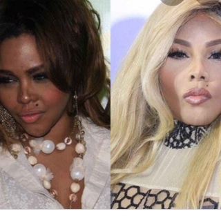 Melanin vs skin whitening