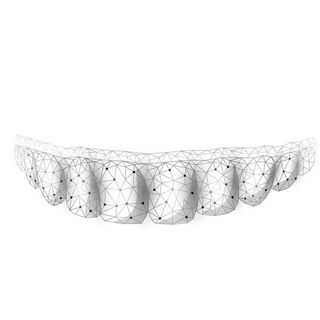Le mascherine per allineare i denti sono efficaci?
