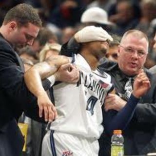 Crazy NBA Facts That You Didn't Know, His Eye Popped Out (Allan Ray)