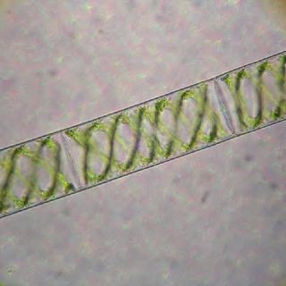 Spirogyra : Que Plâncton é Esse?