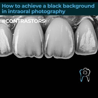 How to get a black background in intraoral photography #CONTRASTORS