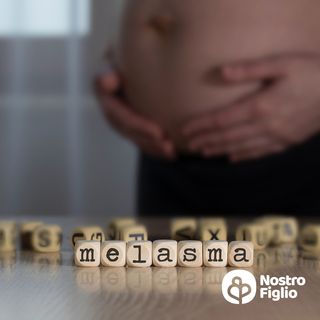 Melasma gravidico, cosa fare?