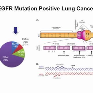 Highlights in Lung Cancer, 2012: New Options for EGFR Mutation-Positive NSCLC (video)