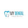 mydental implants