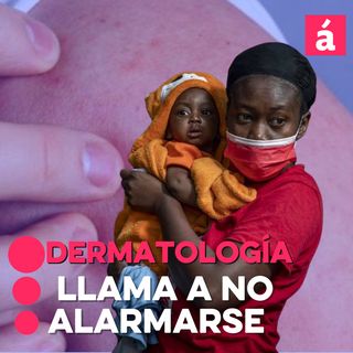 Sociedad Dominicana de Dermatología llama a no alarmarse ante enfermedad cutánea en Haití