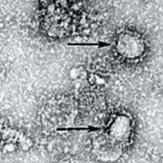 Asciende a 813 los muertos coronavirus en China