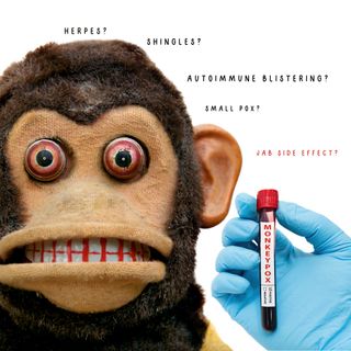 Episode 160- Don't Do It, Monkey Pox Vaccine