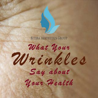 What Your Wrinkles Say about Your Health