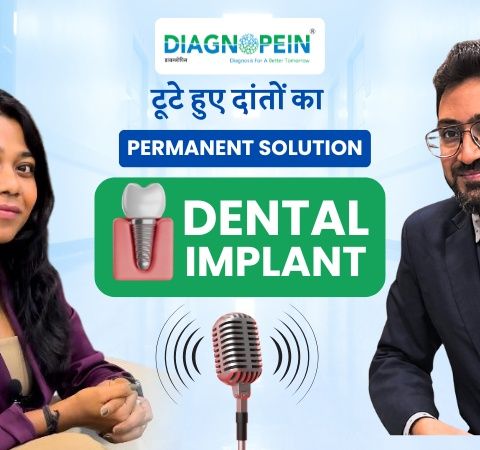Permanent Solution for Broken Teeth - Dental Implant