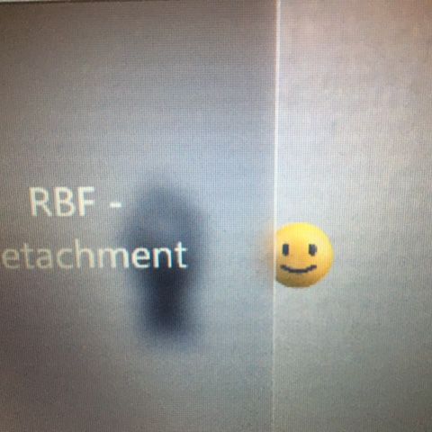 RBF-Detachment ♪