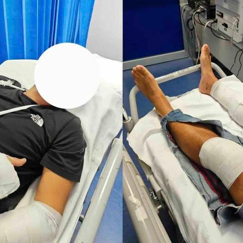 Napoli, orrore sull'Asse Mediano: bastonato a sangue per un'auto vecchia di 10 anni