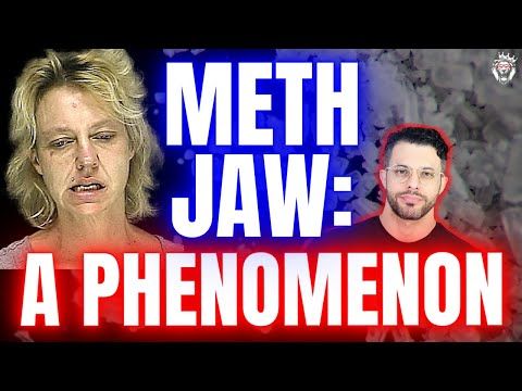 Meth Jaw