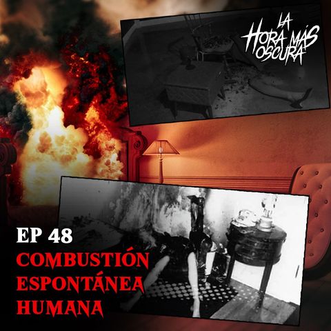 Ep48: Combustión Espontánea Humana