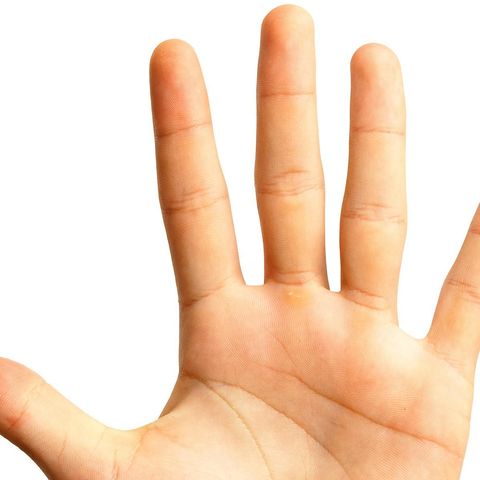 Il Dottore Giorgio Pivato ci racconta delle principali patologie della mano