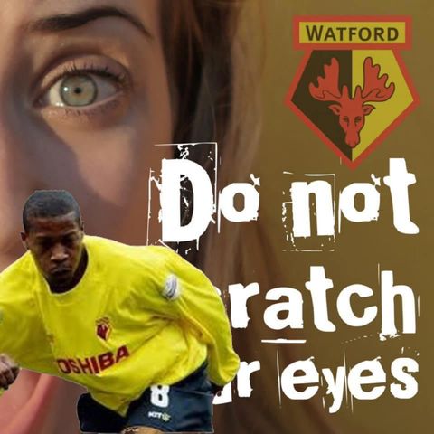 Do Not Scratch Your Eyes - Micah Hyde Special - S1 Ep22