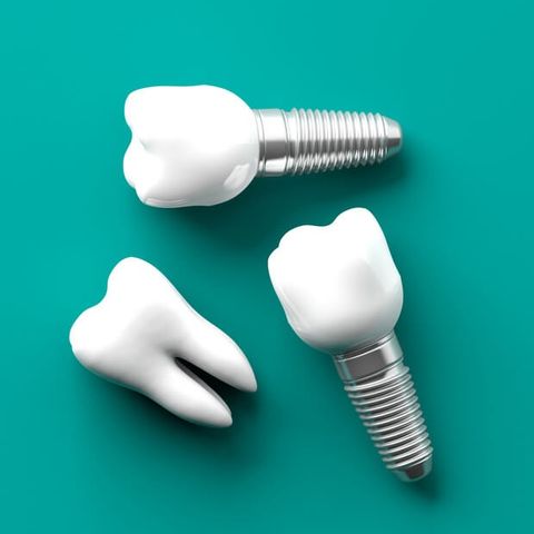 Reduce throbbing pain after getting dental implants