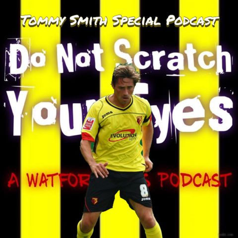 Do Not Scratch Your Eyes - Tommy Smith Special - S1 Ep34