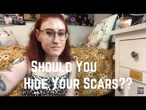 Should You Hide Your Self Harm Scars??