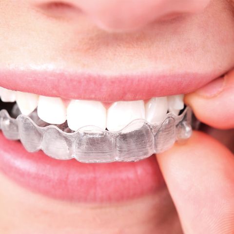 Orthodontist LasVegas