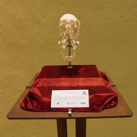 “Cranio esploso” o “Cranio di Beauchêne”