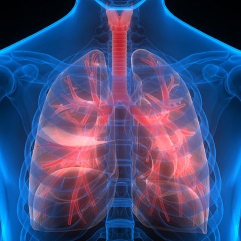 The No. 3 Killer  - Lung Diseases