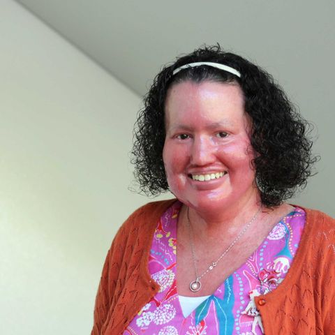 Hello Carly Findlay