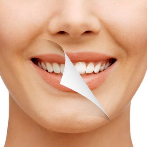 Clareamento Dental #Podcast1 #clareamento dental #envie sua dúvida