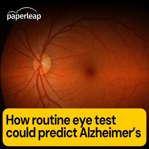 How routine eye test could predict Alzheimer’s