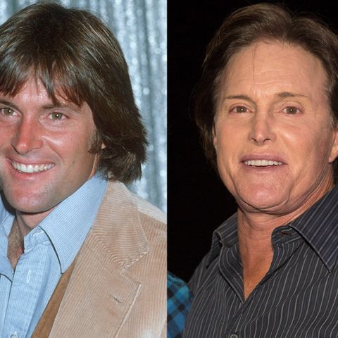 the bruce jenner before and after