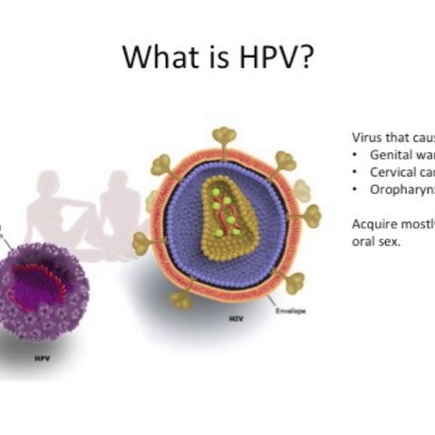HPV in Head and Neck Cancer, Part 1: What is it and What Does it Mean? (video)