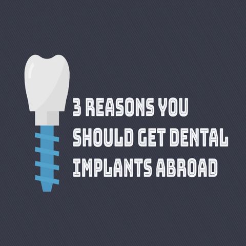 3 Reasons You Should Get Dental Implants Abroad