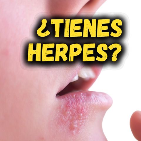 ¿TIENES HERPES? 🧏🏻‍♀️