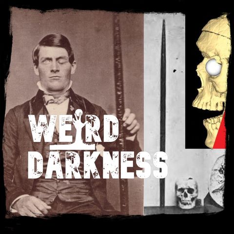 (Non-Christmas Episode!) “THE IMPALED BRAIN OF PHINEAS GAGE” #WeirdDarkness